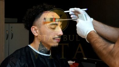 Istanbul Vita Expert Care for Afro Hair Transplants