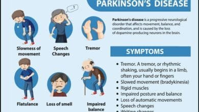 Parkinson